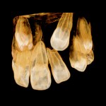 xray of crooked teeth