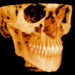 scan of scull and teeth