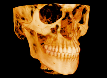 scan of scull and teeth