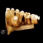 scan of teeth image 4