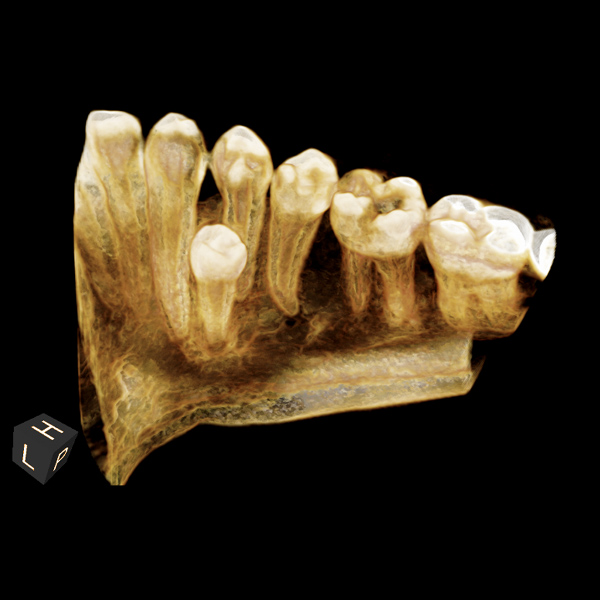 scan of teeth image 4