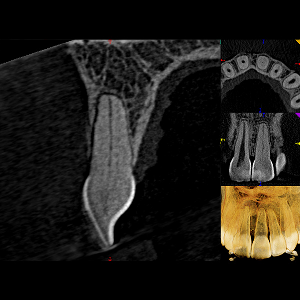 teeth xrays