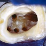 magnified tooth