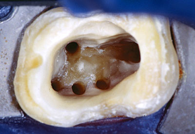 magnified tooth